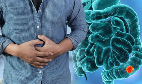 Put simply, bowel obstruction refers to any blockage or barrier within the small or large intestines that prevents partially digested food, digestive juices however, this condition should be taken seriously otherwise it can cause some very critical complications. Bowel cancer symptoms: Signs the disease has advanced ...