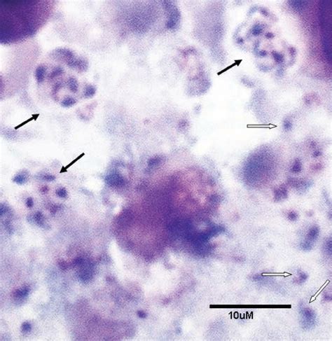 Pneumocystis Carinii Trophic And Cyst Forms Touch Preparation Of An