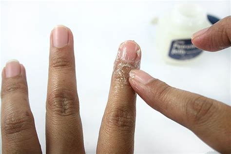 How To Fix The Skin Around Your Nails 13 Steps With Pictures Nail