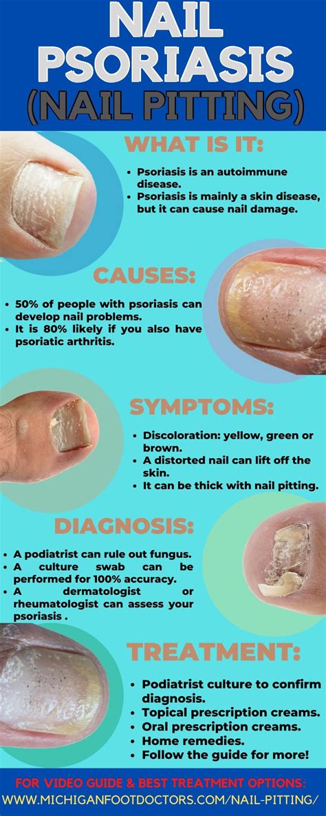 Nail Pitting Causes Symptoms Home Remedies And Best Treatment