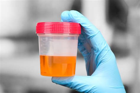 Trace Intact Blood Urine Urine Test Definition Disease Detection And