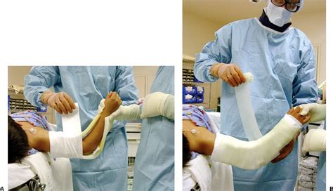 Cast And Splint Immobilization Remodeling And Special Issues Of