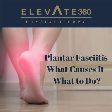 Plantar Fasciitis What Causes It And What To Do Elevate Physiotherapy