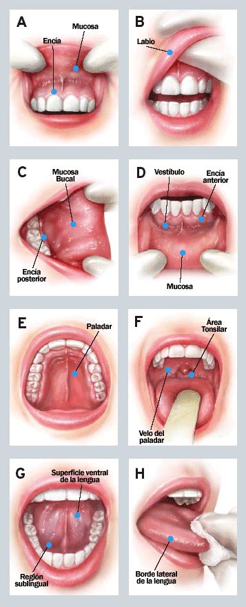 Oral Self Examination To Prevent Oral Cancer Clínica Dental Gazel