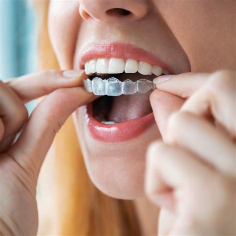 The Pros And Cons Of At Home Teeth Aligners According To A Dentist