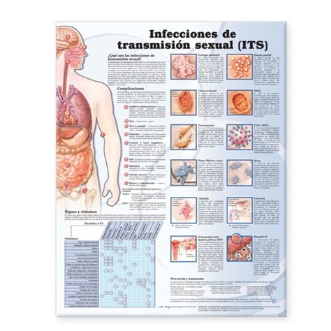 Sexually Transmitted Infections Anatomical Chart In Spanish Infecciones De Transmisión Sexual