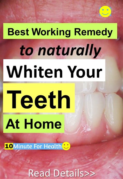 Best Remedy To Naturally Whiten Your Teeth At Home 10 Minute For Health