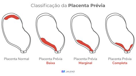 anatomia de la placenta talediy