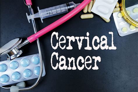 Cancerul De Col Uterin Cauze Manifestari Si Optiuni De Tratament Dr