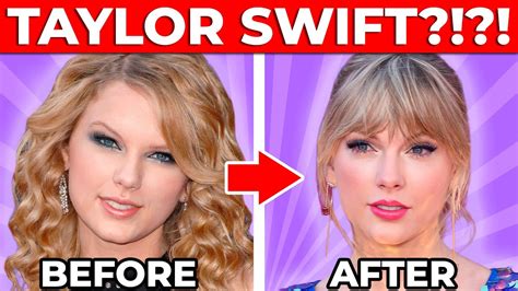 Plastic Surgeon Reacts To Taylor Swifts Plastic Surgery Transformation