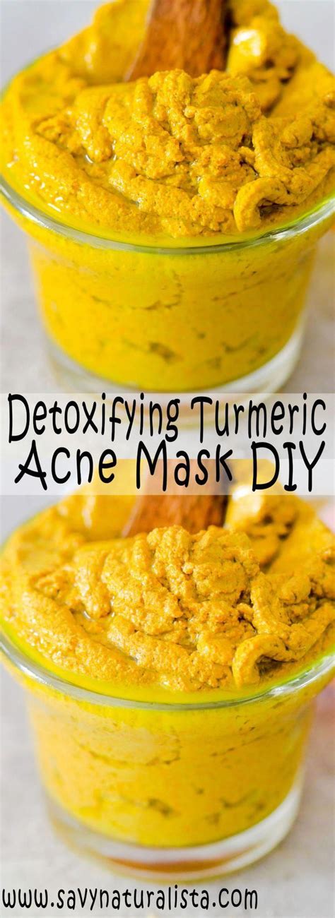 This Easy Detoxifying Turmeric Acne Face Mask Only Requires A Few