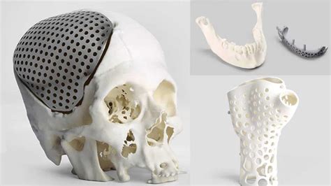 3d Printed Bones The Most Jaw Dropping Projects In 2020 All3dp