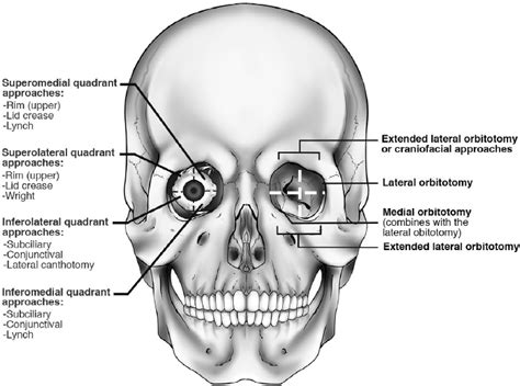Intra Orbital Pathologies And Surgical Approaches Neupsy Key