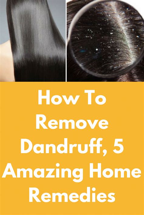 Jul 09, 2020 · baking soda is also known to reduce the overactive fungi that can cause dandruff. How To Remove Dandruff, 5 Amazing Home Remedies Dandruff ...