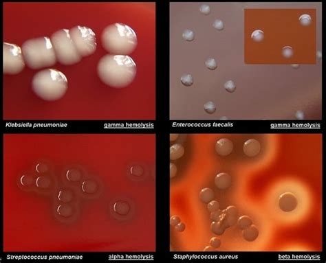 Blood Agar Composition Preparation Uses And Pictures
