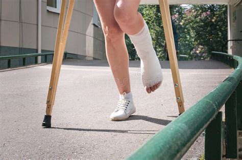 134 Woman Leg Cast Crutches Hospital Stock Photos Free And Royalty Free