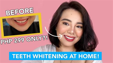 Affordable And Effective Teeth Whitening At Home Ft Perfect Smile