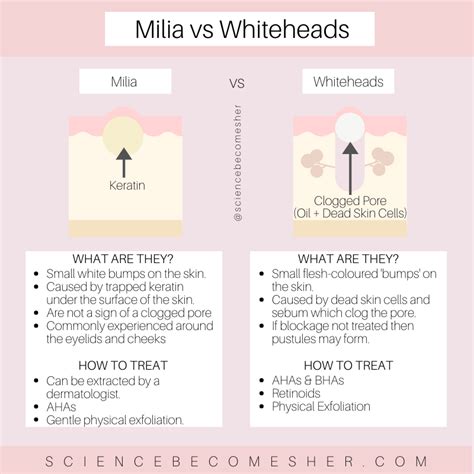 What Are Milia How Are They Different From Whiteheads Can You Get Rid