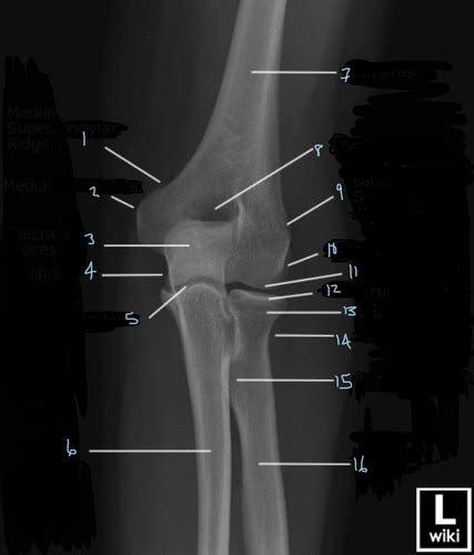 X Ray Elbow Anatomy Flashcards Quizlet
