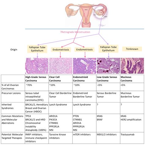 Histological Classification Of Ovarian Carcinoma