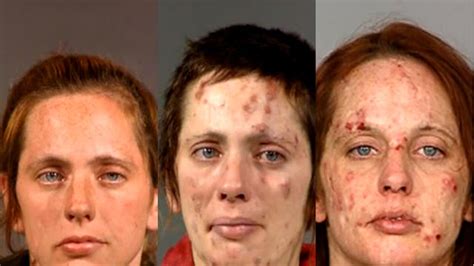 the shocking before and after pictures of meth addicts warning disturbing images the