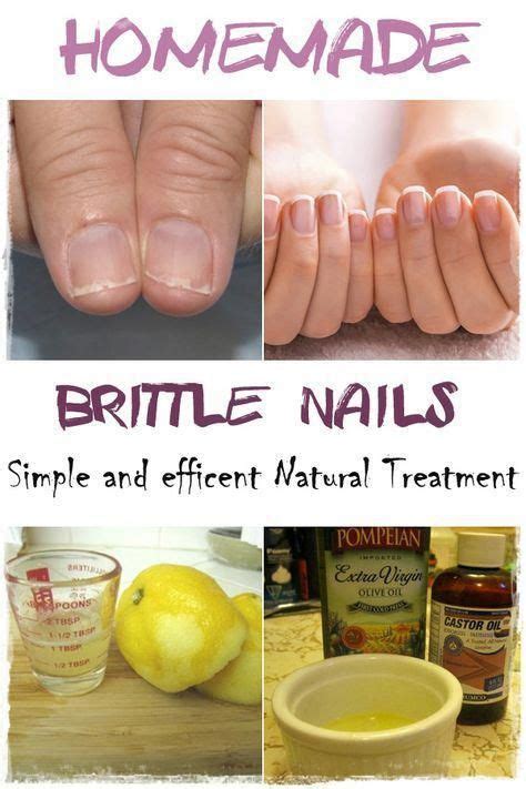 Luckily, we spoke with a pro to learn how to repair hair damage for beautiful, healthy, shiny hair. 11 Effective Remedies to repair Dry, Brittle Nails # ...