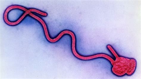 expert interview how do you catch ebola uk health security agency