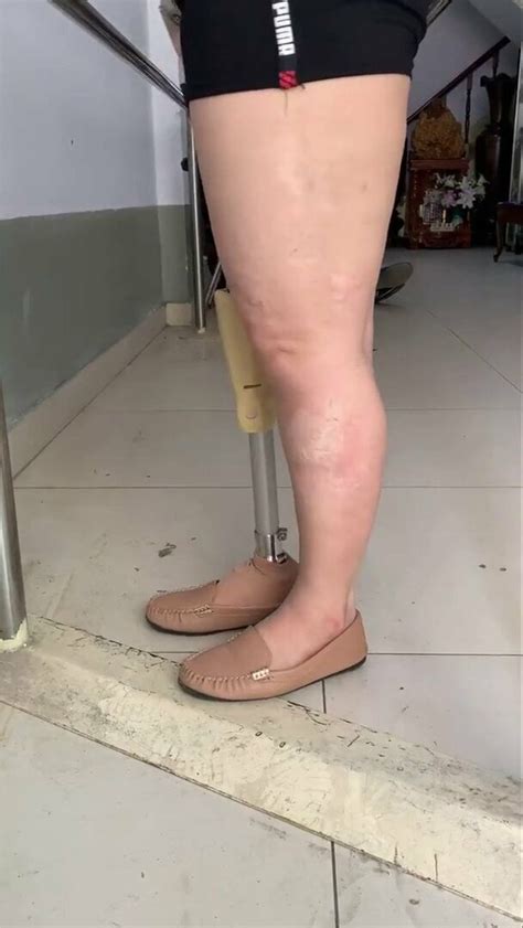 prosthesis amputee shd free hd porn video 03 xhamster xhamster