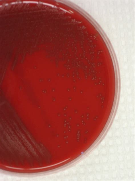 Viridans Streptococcus Virtual Lab Microbiology