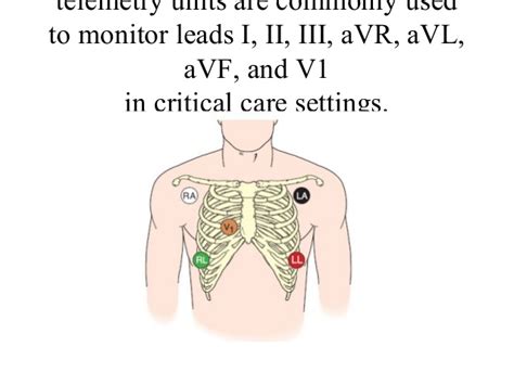 How Can I Synchronise Video Recording With Ekg And Other