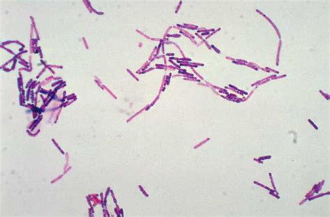 Bacillus Megaterium Gram Staining