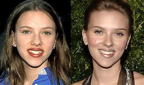 Relatively Shocking Photos Of Celebrities Before And After Plastic Surgery