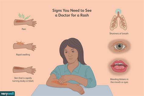 When To Worry About A Rash In Adults 10 Warning Signs