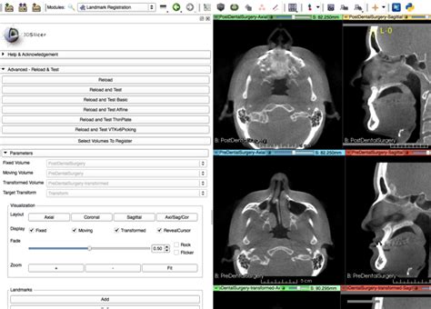 Documentationnightlymoduleslandmarkregistration Slicer Wiki