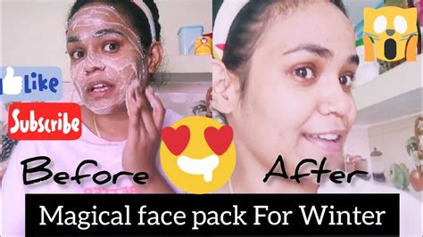 Winter Skin Care Hacks Vlog ।। Face Pack For Winter।। Skincare Vlog