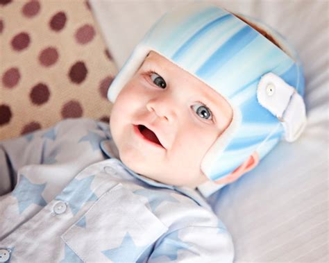 10 Ways To Prevent Plagiocephaly In Babies Flat Head Syndrome