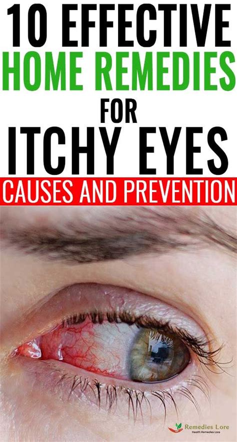 10 Effective Home Remedies For Itchy Eyes Causes And Prevention