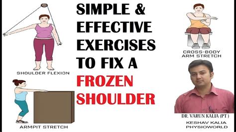 Simple Effective Exercises To Fix A Frozen Shoulder Youtube