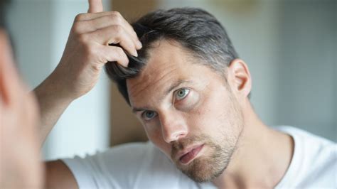 Treating Male Pattern Hair Loss Philip Kingsley