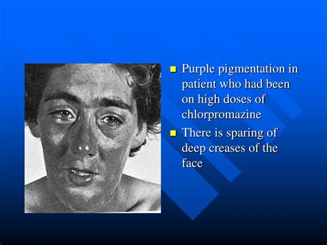 Ppt Part Ii Contact Dermatitis And Drug Eruptions Powerpoint