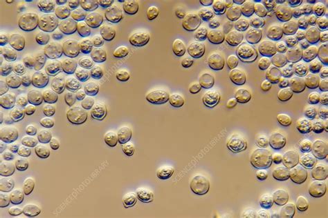 Saccharomyces Cerevisiae Yeast Budding Cell Under Microscope Royalty