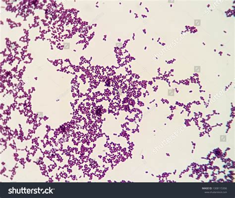 Gram Positive Cocci Cluster Stapylococcus Spp Stock Photo 1308115306