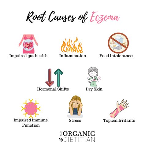 7 Root Causes Of Eczema How To Start Healing Your Skin From Within
