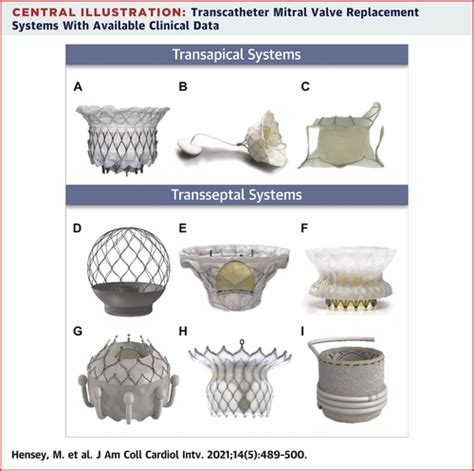 Transcatheter Mitral Valve Replacement An Update On Current Techniques