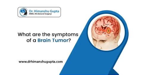 What Are The Symptoms Of A Brain Tumor