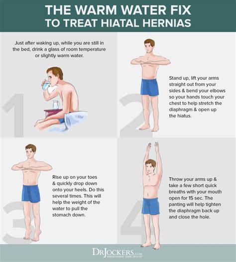 How To Relieve Pain From Hernia Cares Healthy