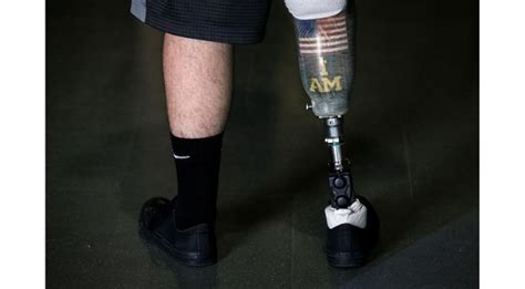 Amputees Can Now Feel Their Feet Just Like A Real Leg Thanks To This New Prosthetic