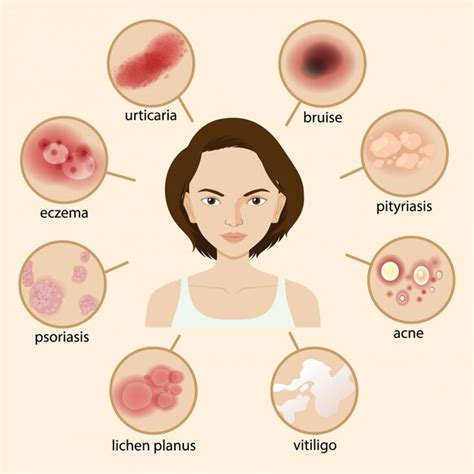 Understanding Managing Skin Rashes Symptoms Treatments
