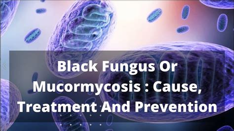 Black Fungus Or Mucormycosis Cause Treatment And Prevention Youtube