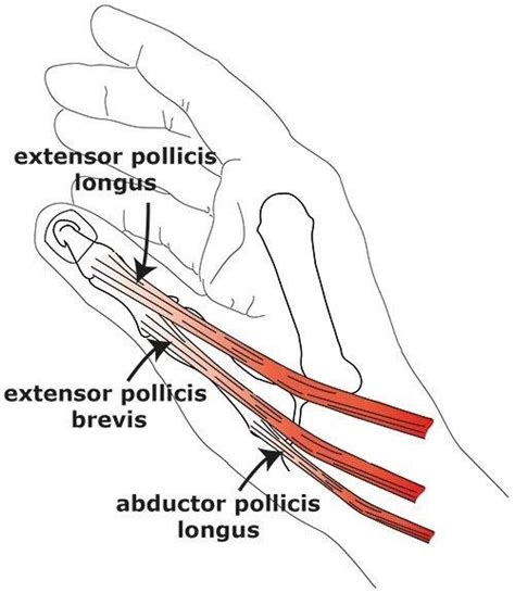 Hand Therapy Short Extensor Tendon Repair Of The Thumb North Tees And Hartlepool Nhs